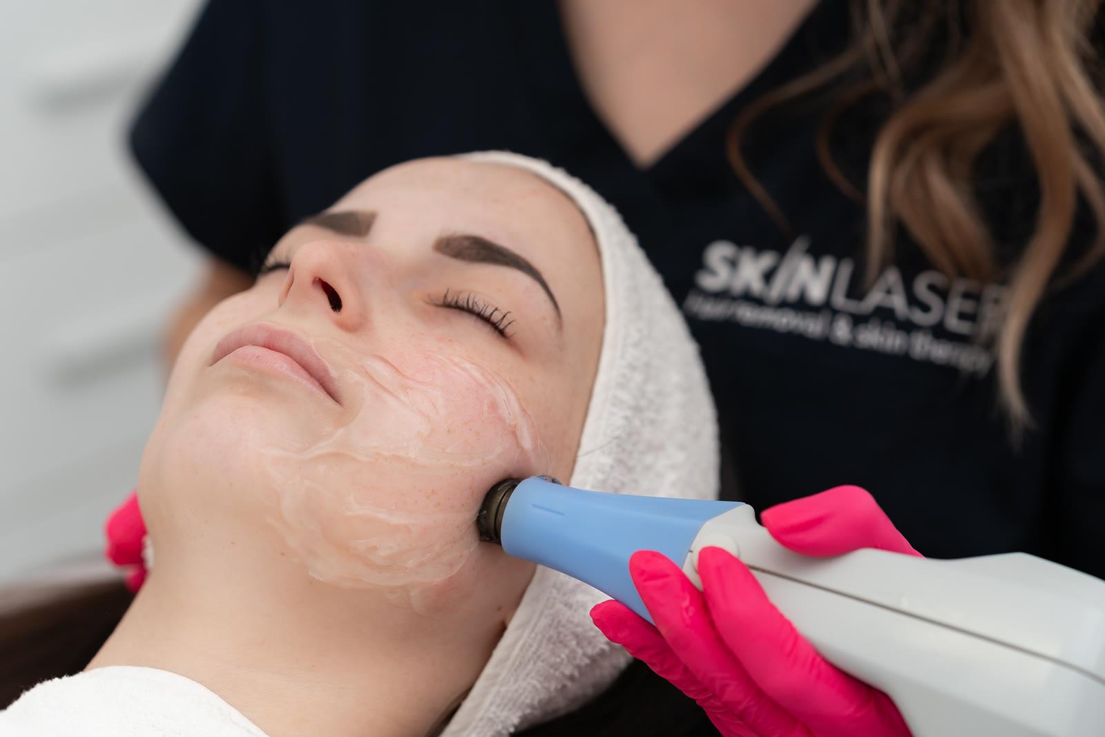 Специалист в Skin Laser прилага процедура за лице с апарат BTL Exilis Ultra