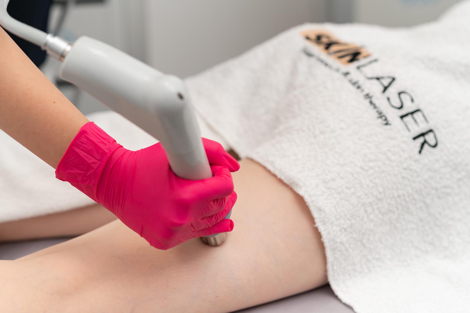 Антицелулитна терапия с акустични вълни BTL X-Wave в Skin Laser
