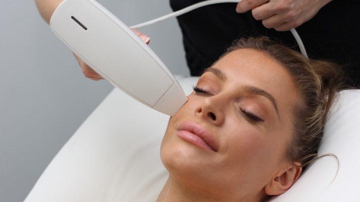 Апарат Venus Viva MD за фракционен радиочестотен ресърфейсинг в Skin Laser